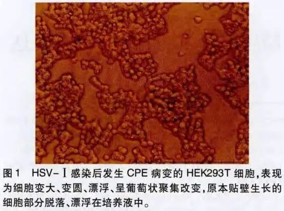 99草草国产熟女视频在线
